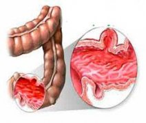 ����֭������θ����ʲô����