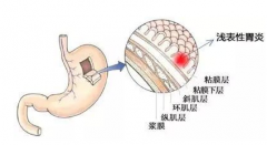 Ԫ������ ��ô�ԲŽ�����